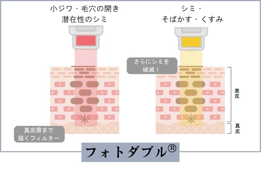 フォトダブル®︎